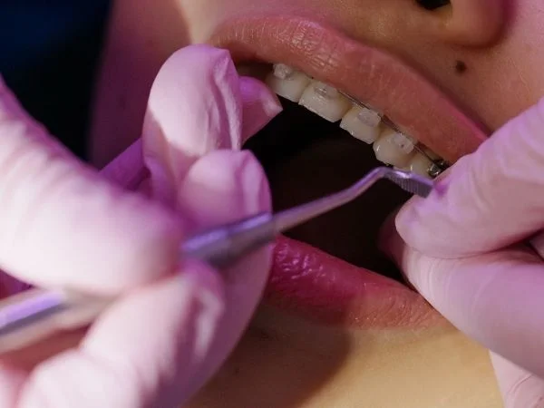 Cosa serve per studiare odontoiatria?